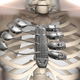 Illustration for article titled The Worlds First 3D-Printed Titanium Rib Cage Is a Medical Marvel